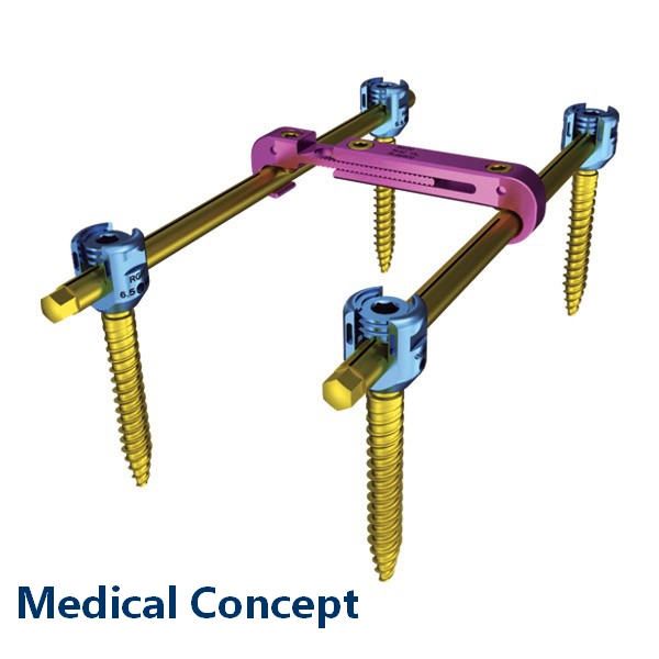 Транспедикулярна конструкція Medical Concept (4 гвинта)